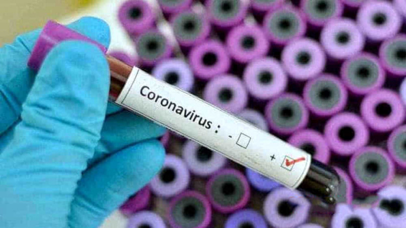 Città di Casale Monferrato - #CoronaVirus - 13 / 16 marzo 2020